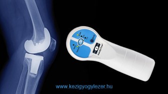 Lágylézer és az implantátumok